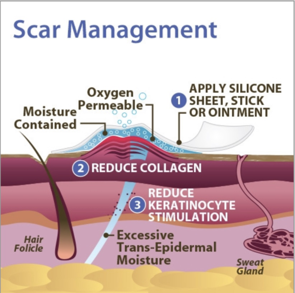 Collagen reduction and scar management process diagram